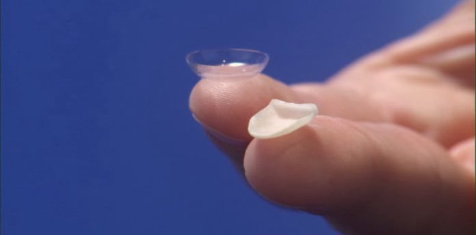 Facetas de Porcelana