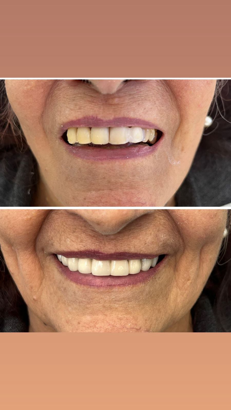 Sorriso transformado