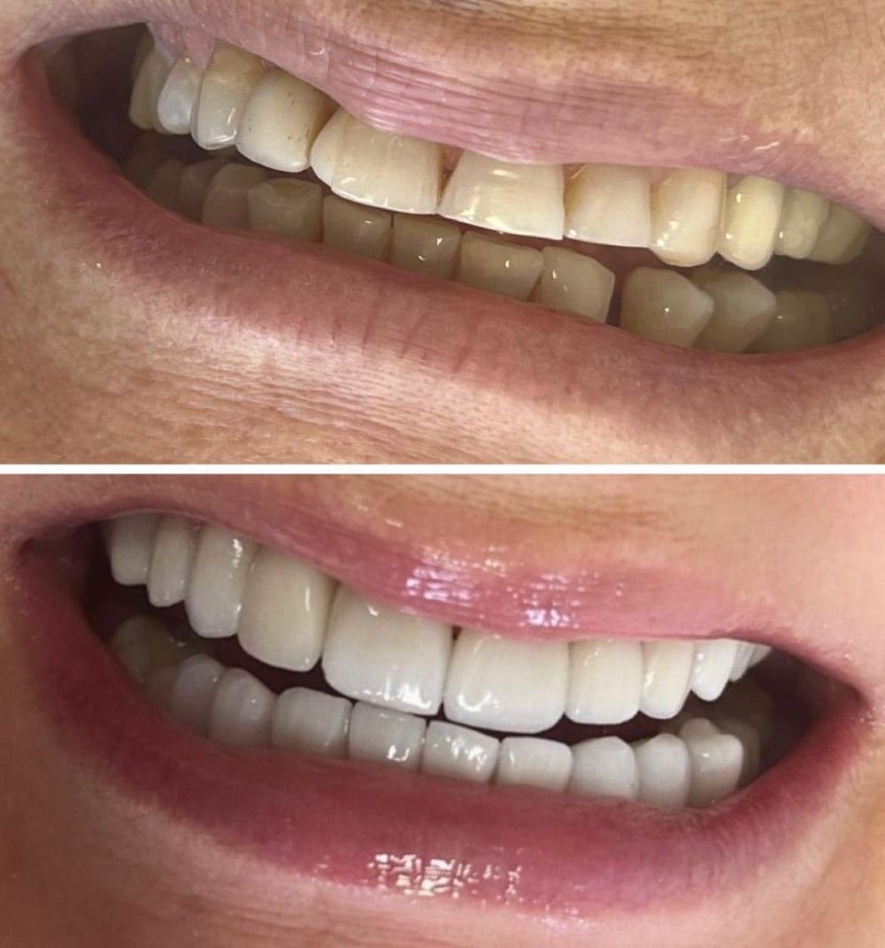 Sorriso transformado