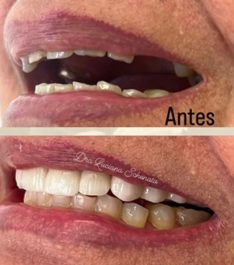 Sorriso transformado