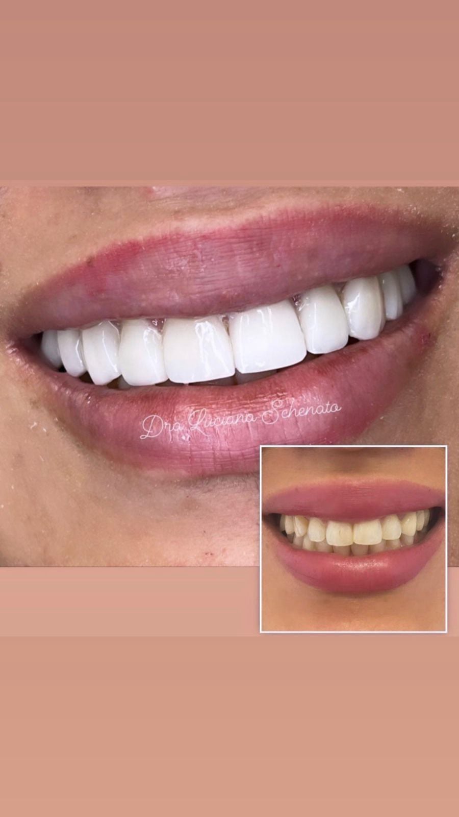 Sorriso transformado