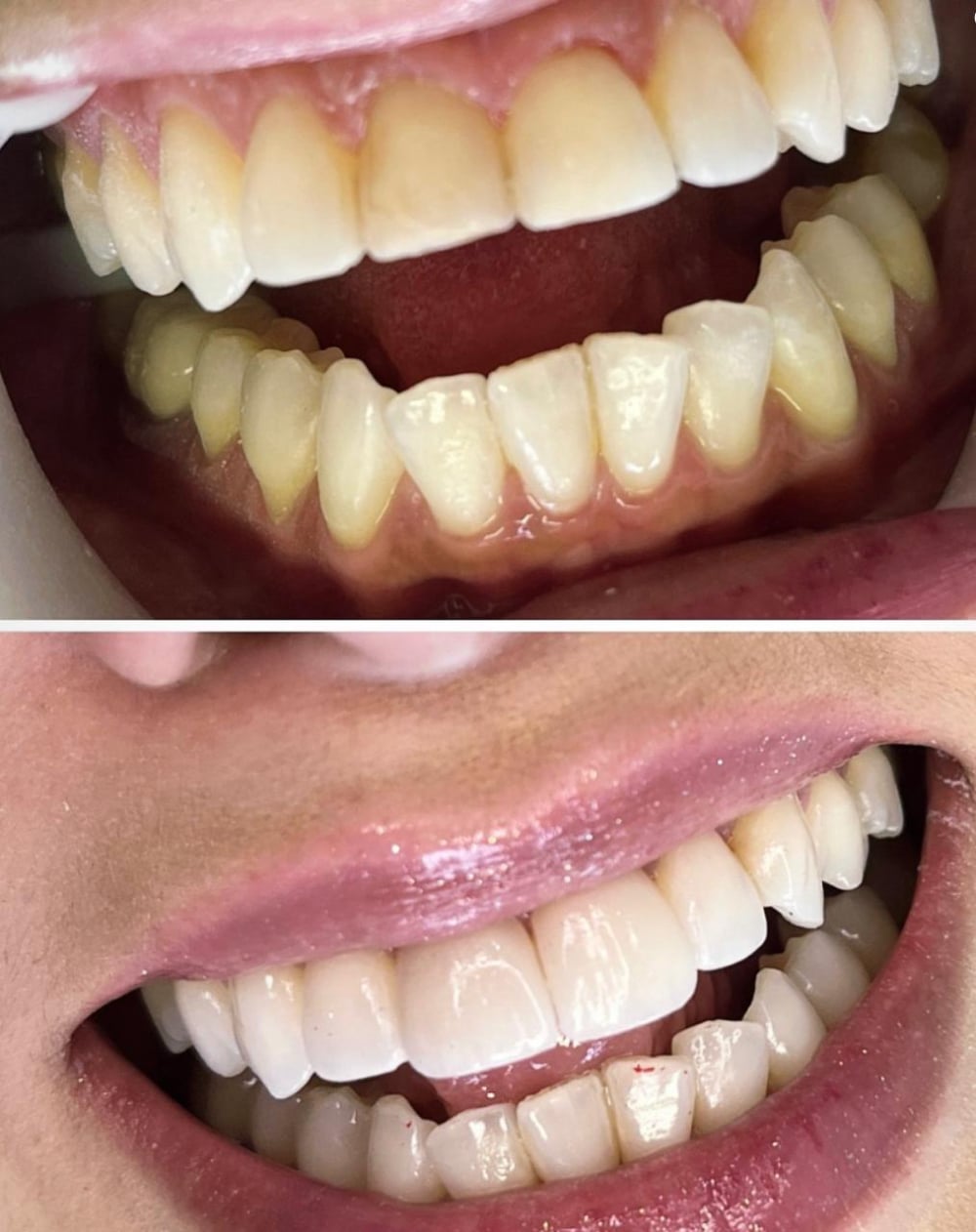 Sorriso transformado